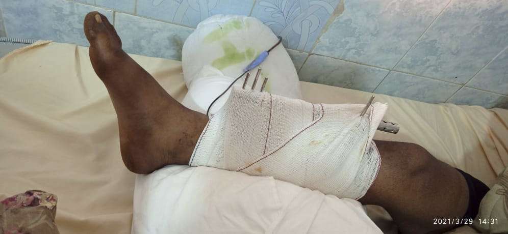 Fadili Bahi en el hospital de Tindouf PHOTO/ Asociación Saharaui para la Defensa de los Derechos Humanos (ASADEDH)