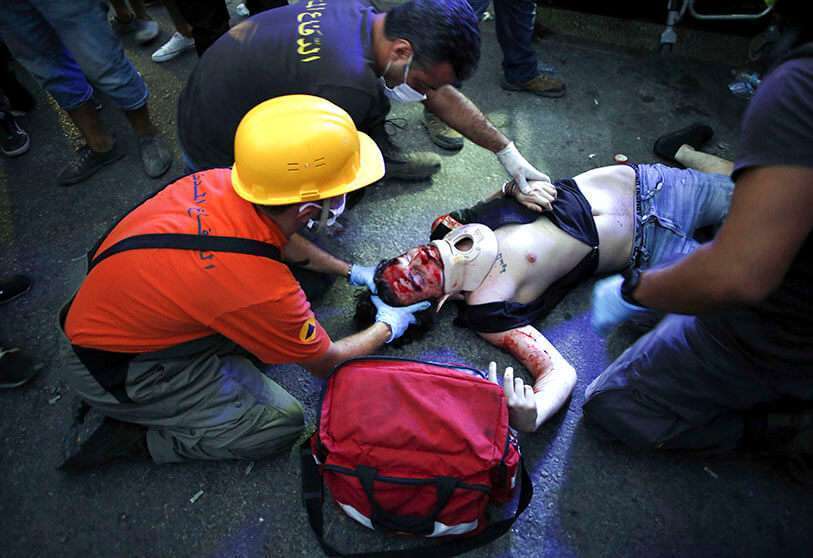 AP/THIBAULT CAMUS - Un manifestante herido yace en el suelo durante los enfrentamientos con la policía como parte de una protesta contra las élites políticas y el gobierno después de la mortal explosión de esta semana en el puerto de Beirut que devastó gran parte de la capital en Beirut, Líbano, el sábado 8 de agosto de 2020