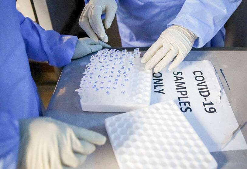 Tubos de microcentrífuga que contienen muestras de pacientes para ser investigadas en el laboratorio Pathologists Lancet Kenya en Nairobi, Kenia