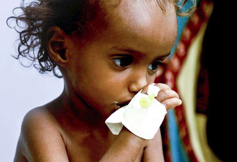 Yemen es, según la ONU, la peor crisis humanitaria del mundo